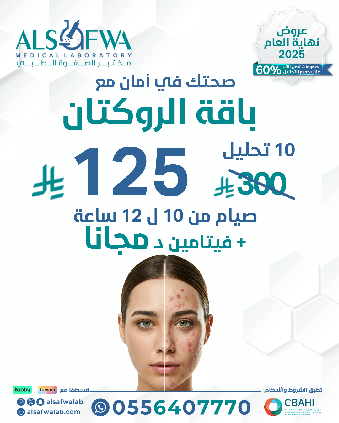 باقة-الروكتان